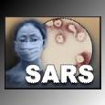 picture representing SARS